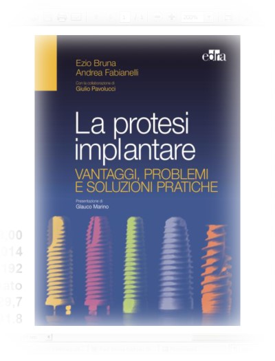 La protesi implantare - Vantaggi, problemi e soluzioni pratiche